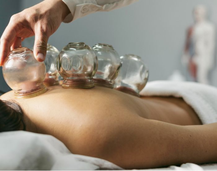 Médecine traditionnelle chinoise : ventouses thérapeutiques et acupuncture au service des douleurs