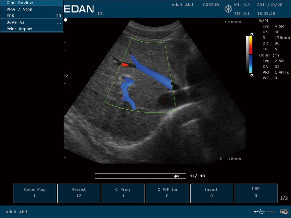 7-2-color-dopper-imaging-of-hepatic-vessels-.jpg