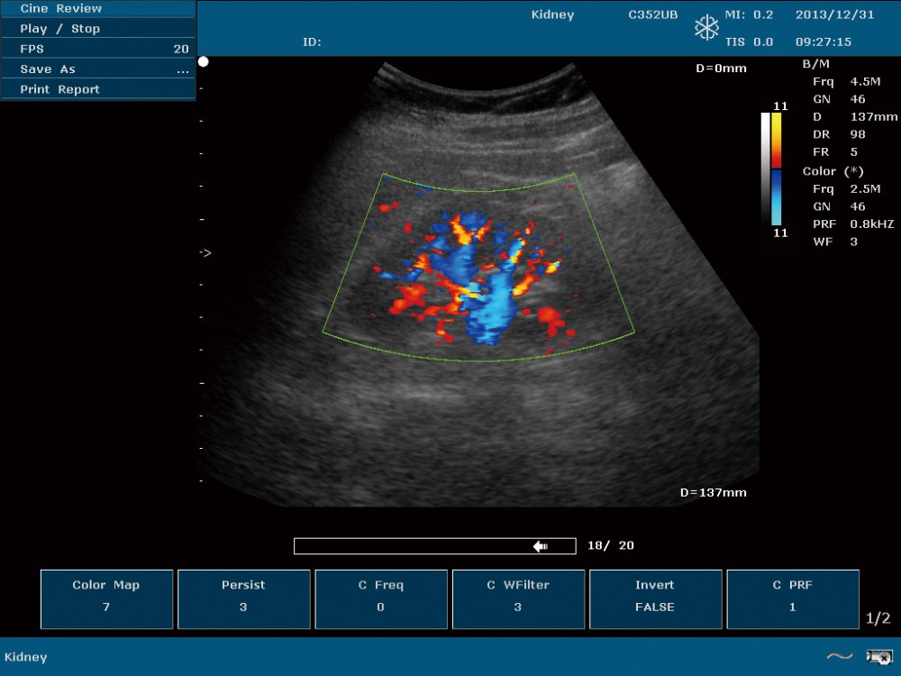7-3-color-doppler-imaging-of-kidney.jpg